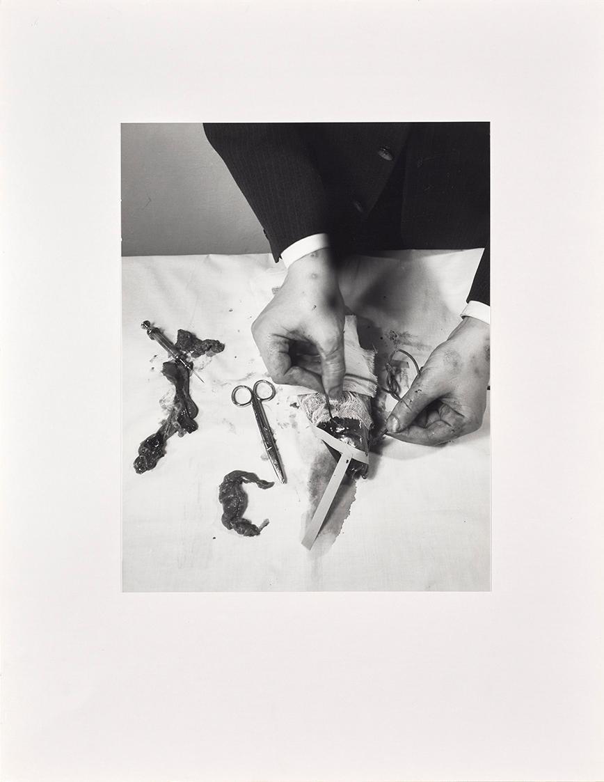 Rudolf Schwarzkogler, 2. Aktion, 1965, Fotografie, 38,5 × 30,4 cm, Belvedere, Wien, Inv.-Nr. 88…