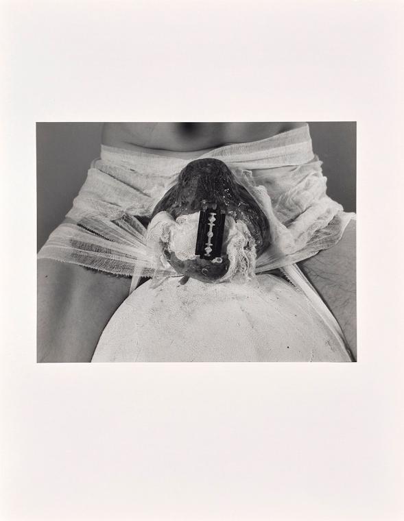 Rudolf Schwarzkogler, 2. Aktion, 1965, Fotografie, 29,5 × 39,4 cm, Belvedere, Wien, Inv.-Nr. 88…