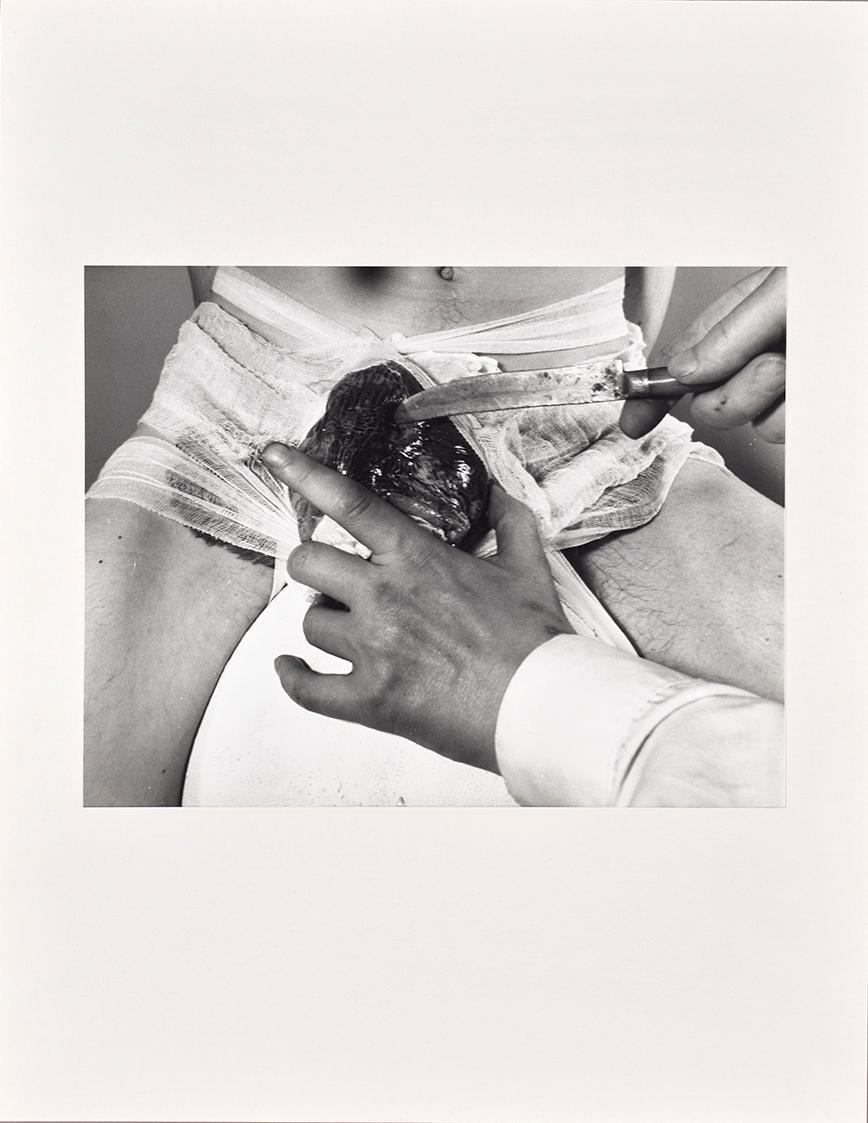 Rudolf Schwarzkogler, 2. Aktion, 1965, Fotografie, 30,3 × 39,4 cm, Belvedere, Wien, Inv.-Nr. 88…