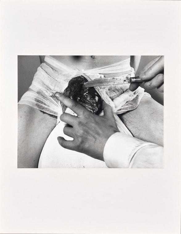 Rudolf Schwarzkogler, 2. Aktion, 1965, Fotografie, 30,3 × 39,4 cm, Belvedere, Wien, Inv.-Nr. 88…