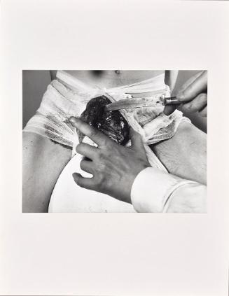 Rudolf Schwarzkogler, 2. Aktion, 1965, Fotografie, 30,3 × 39,4 cm, Belvedere, Wien, Inv.-Nr. 88 ...