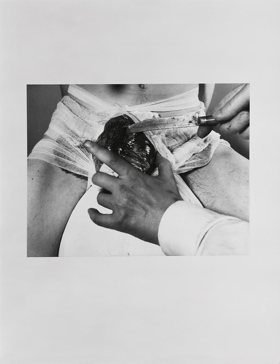 Rudolf Schwarzkogler, 2. Aktion, 1965, Fotografie, 30,3 × 39,4 cm, Belvedere, Wien, Inv.-Nr. 88 ...